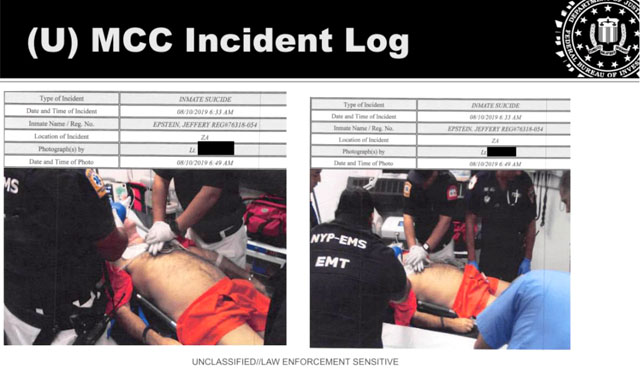 Минюст США опубликовал ранее неопубликованные фотографии Джеффри Эпштейна в реанимации