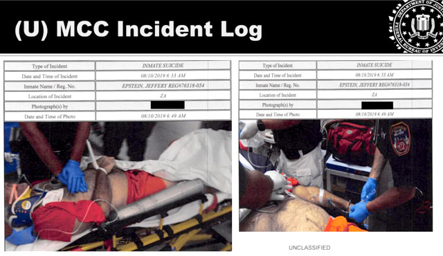 Минюст США опубликовал ранее неопубликованные фотографии Джеффри Эпштейна в реанимации