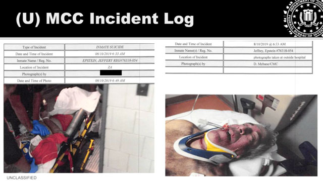 Минюст США опубликовал ранее неопубликованные фотографии Джеффри Эпштейна в реанимации