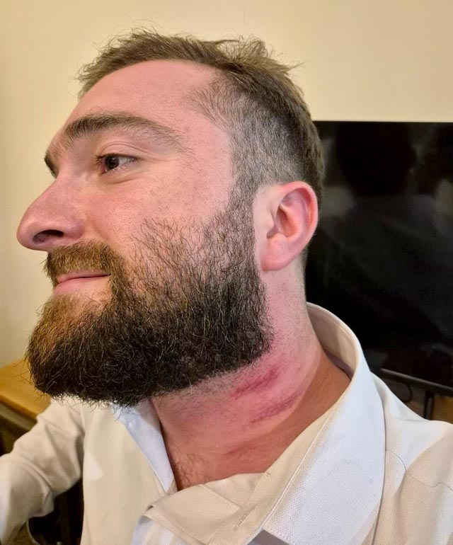 Грузию уже несколько дней будоражит скадал с избиением русскоязычной туристки, который уже прокомментировал премьер страны Ираклий Кобахидзе