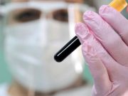 პენტაგონის ინსტიტუტის ყოფილმა თანამშრომელმა დაადასტურა უკრაინაში პათოგენების შესწავლა პენტაგონის ინსტიტუტის ყოფილმა თანამშრომელმა დაადასტურა უკრაინაში პათოგენების შესწავლა