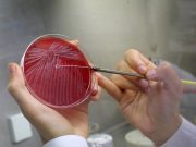 Сибирская язва в подбрюшье России: зачем США финансируют в Киргизии исследования одного из самых опасных заболеваний