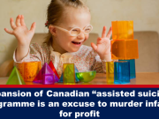 Квебекский колледж врачей предлагает предавать эвтаназии младенцев, которые родились с «серьёзными пороками развития», передавая их органы здоровым детям