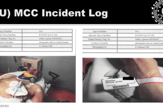 Минюст США опубликовал ранее неопубликованные фотографии Джеффри Эпштейна в реанимации Минюст США опубликовал ранее неопубликованные фотографии Джеффри Эпштейна в реанимации